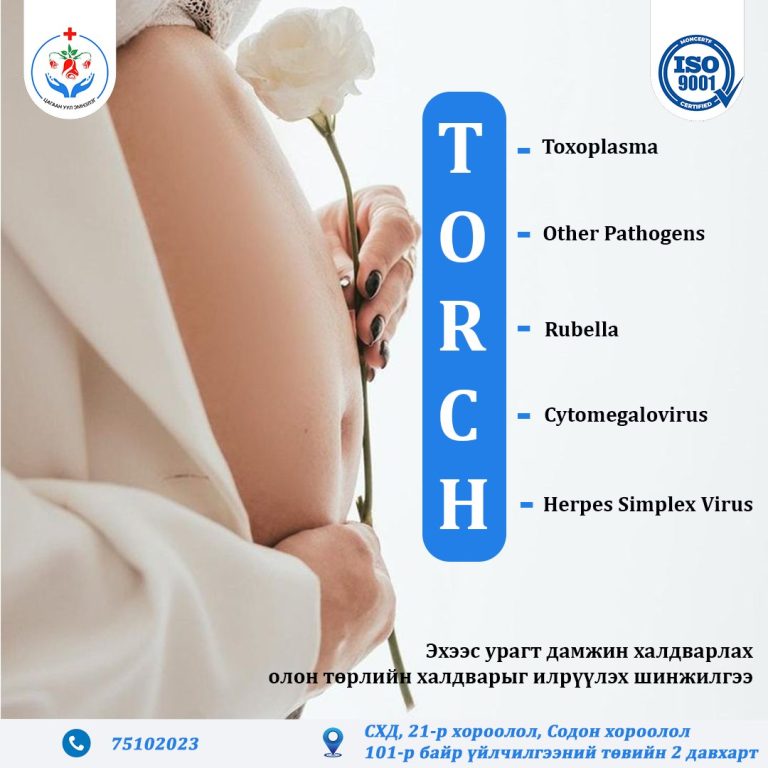 TORCH шинжилгээ